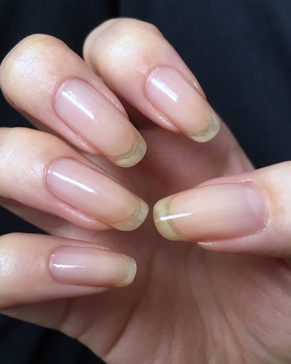 Natural nail