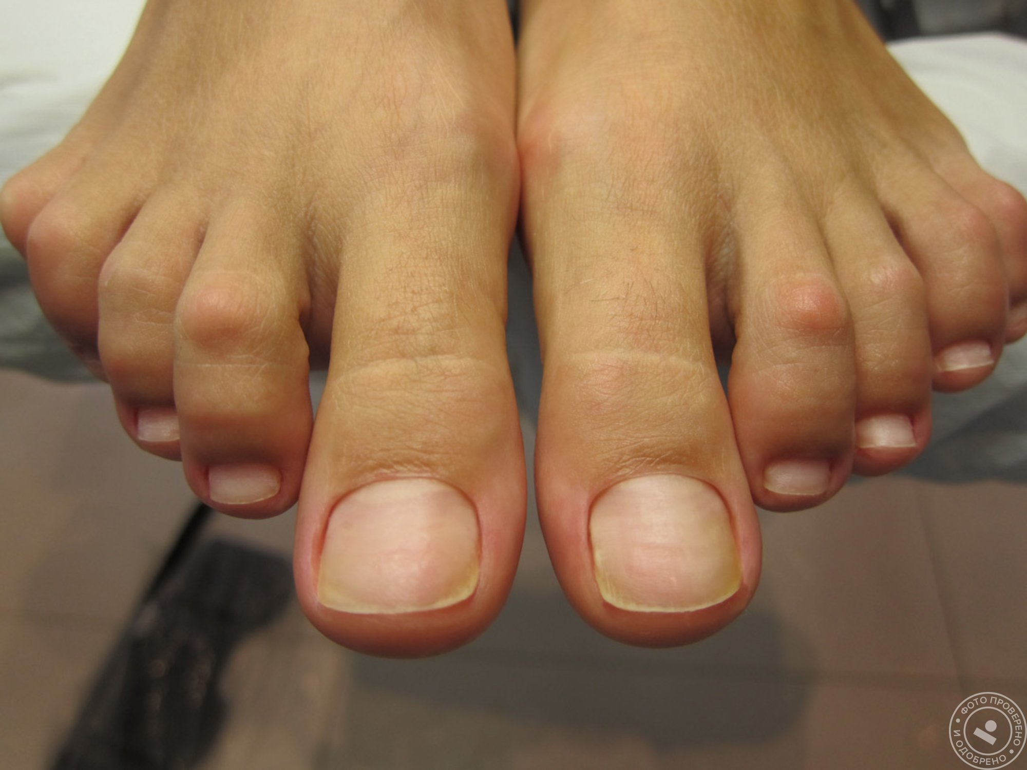 пальцы ног мужские фото