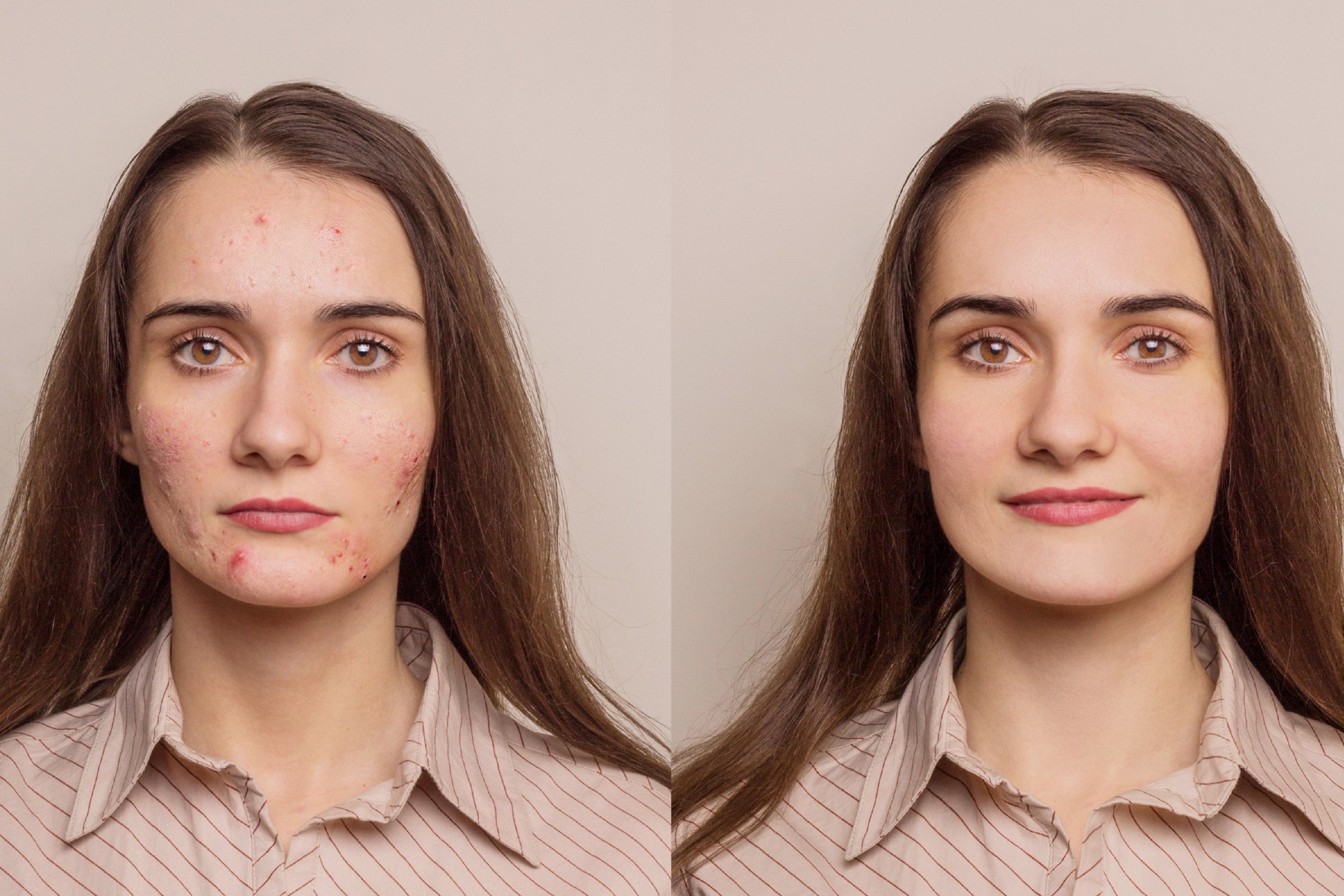 Уязвимо лицо. Девушка с проблемной кожей. Лицо человека женщины.