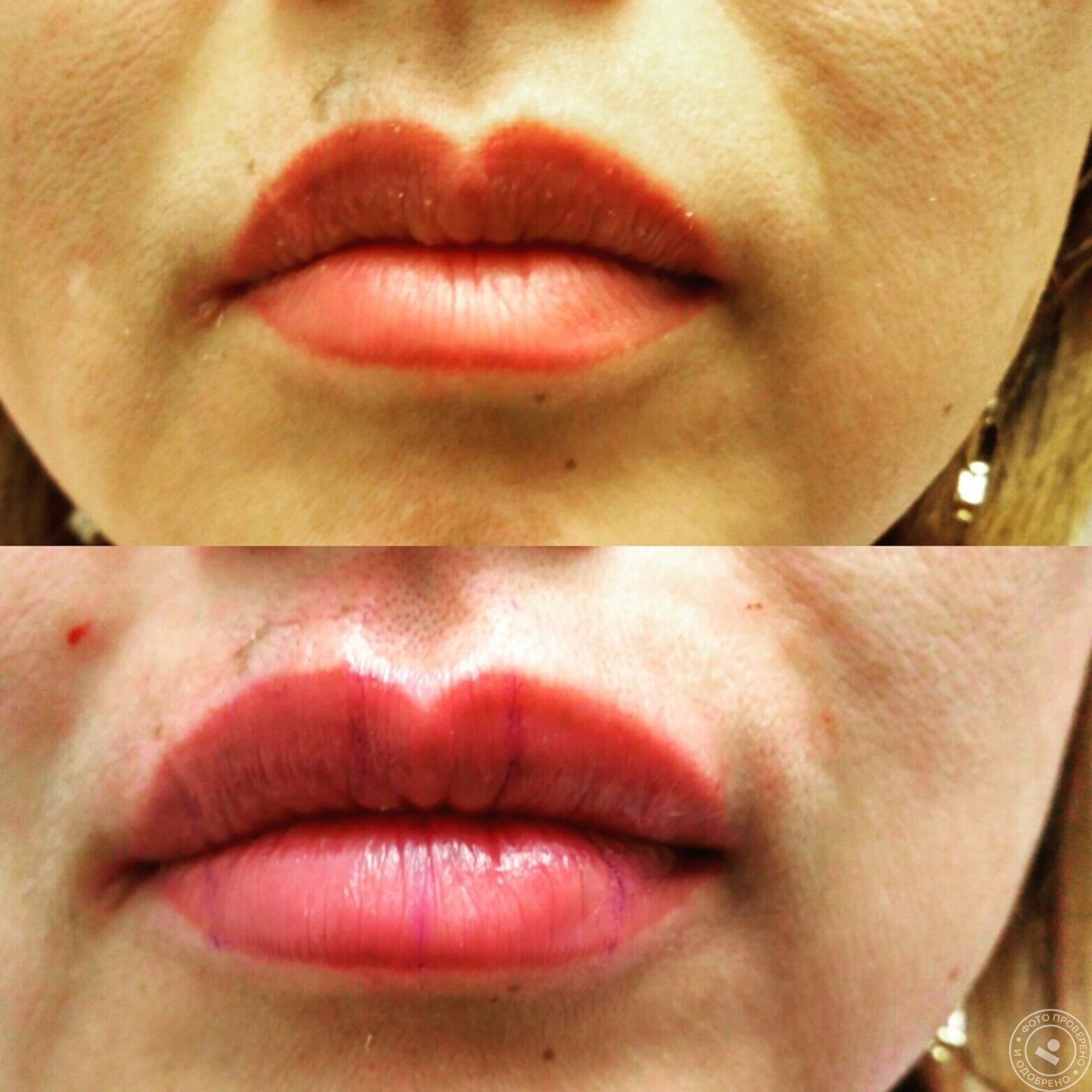 Татуаж или увеличение губ. Контур губ гиалуроновой кислотой зажившие. Перманент губ. Перманентный макияж губ.