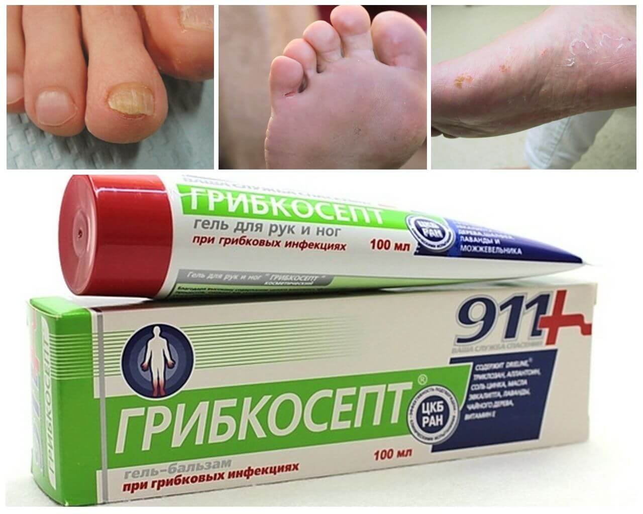 Грибок кожи лечение препараты недорогие но эффективные. Мазь 911 грибкосепт. Грибкосепт 911 от грибка ногтей. Противогрибковый крем для ног.