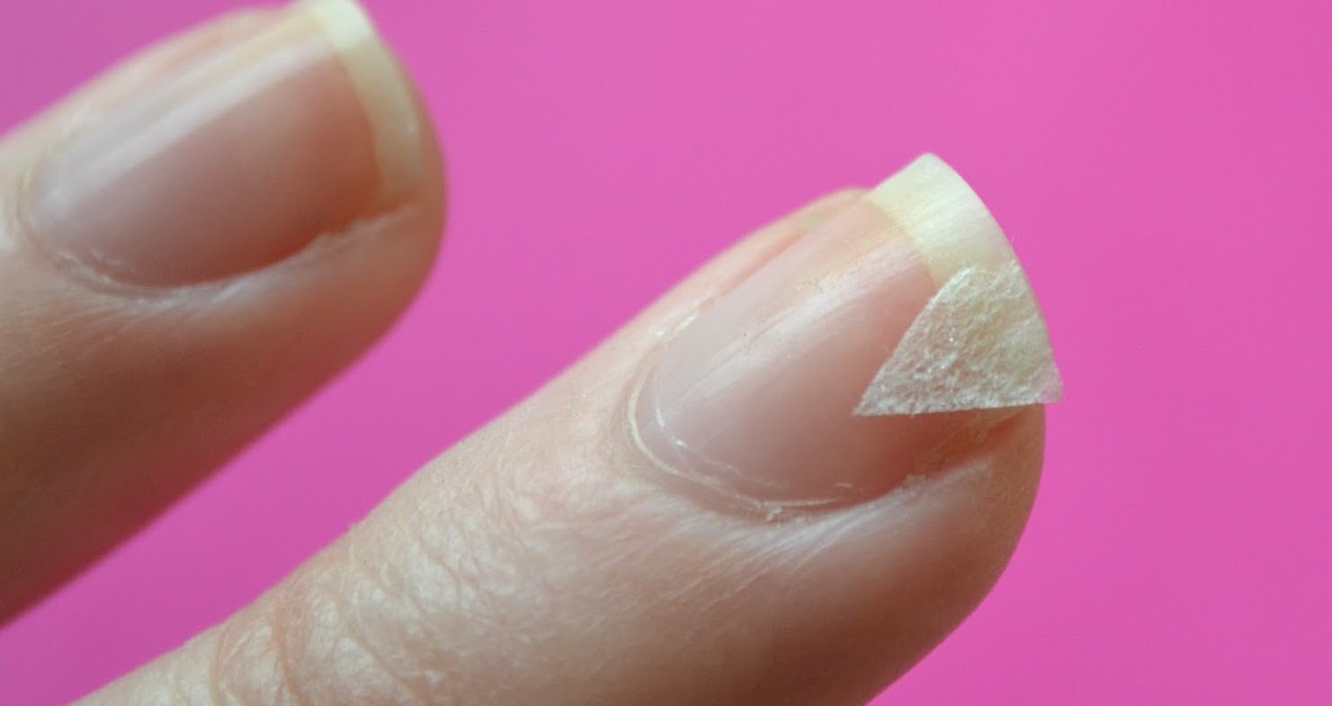 Маникюр трещины. Восстановление ногтевой пластины. Гель для восстановления ногтевой пластины.