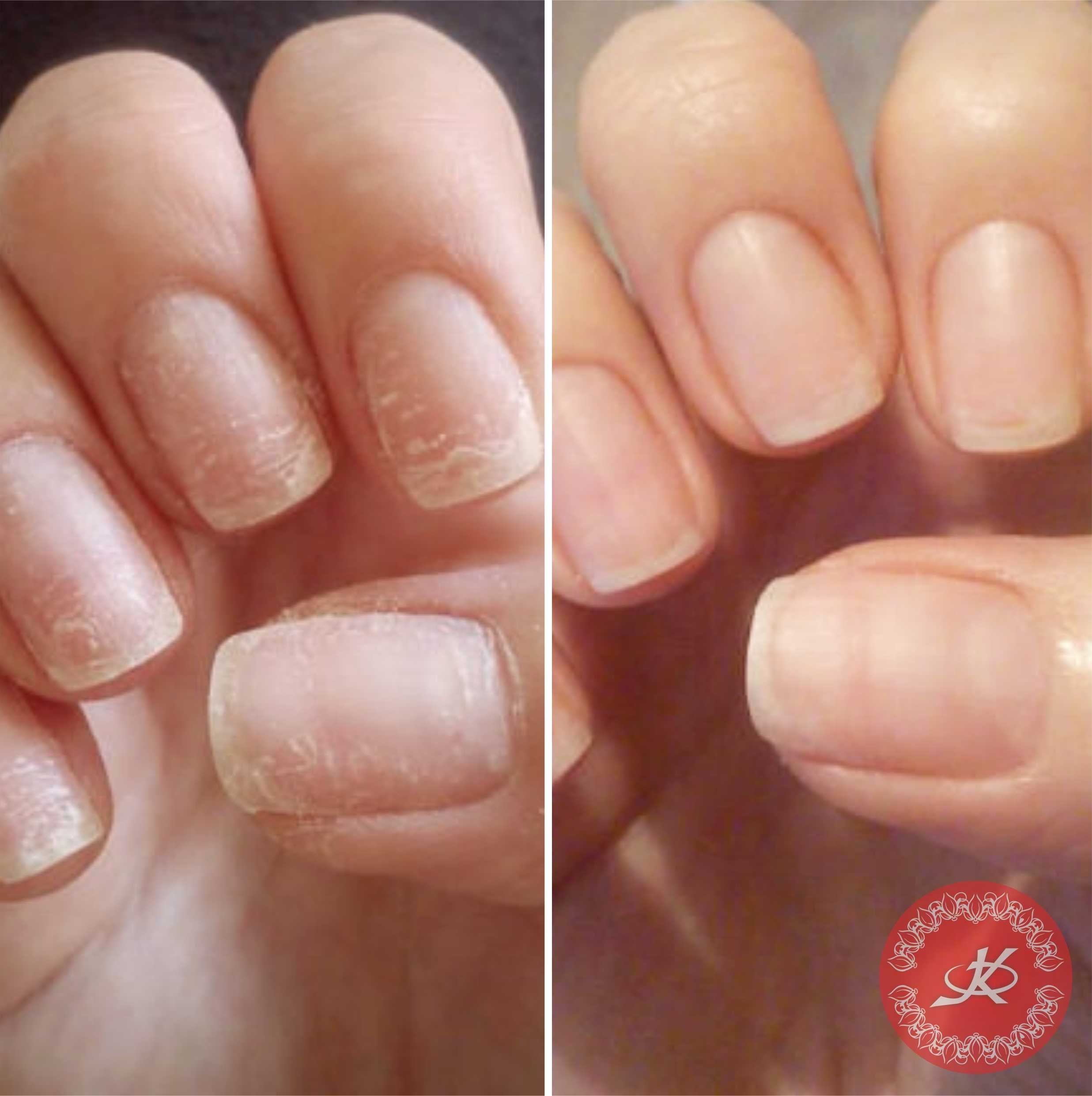 Лечение ногтей после гель. Маникюр + IBX/Vitagel. Маникюр до и после. Гигиенический маникюр без покрытия. Ногти до и после.
