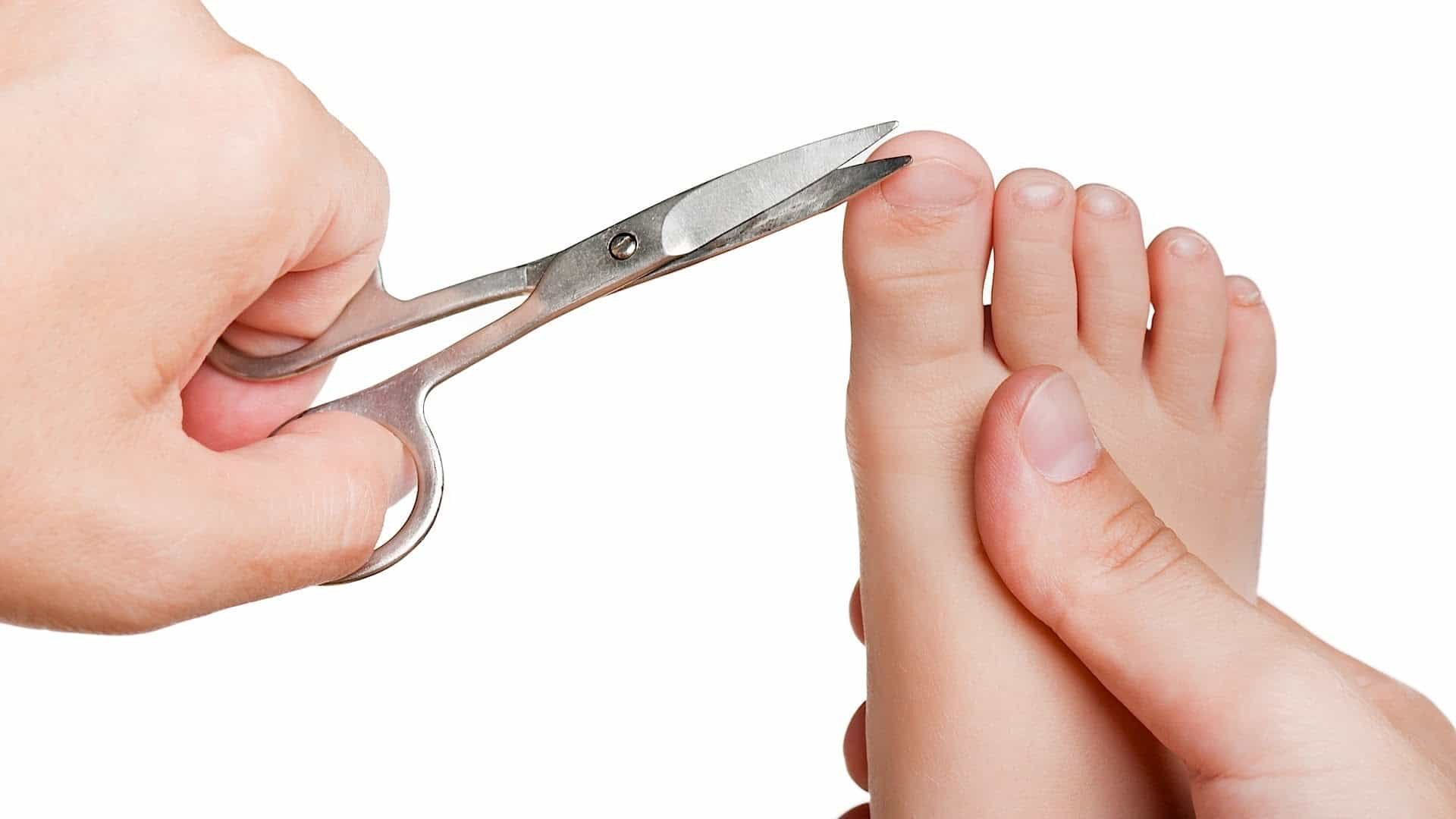 Как подстригать ногти на большом пальце. Подстричь ногти на ногах ребенку. Правильная стрижка ногтей на ногах.