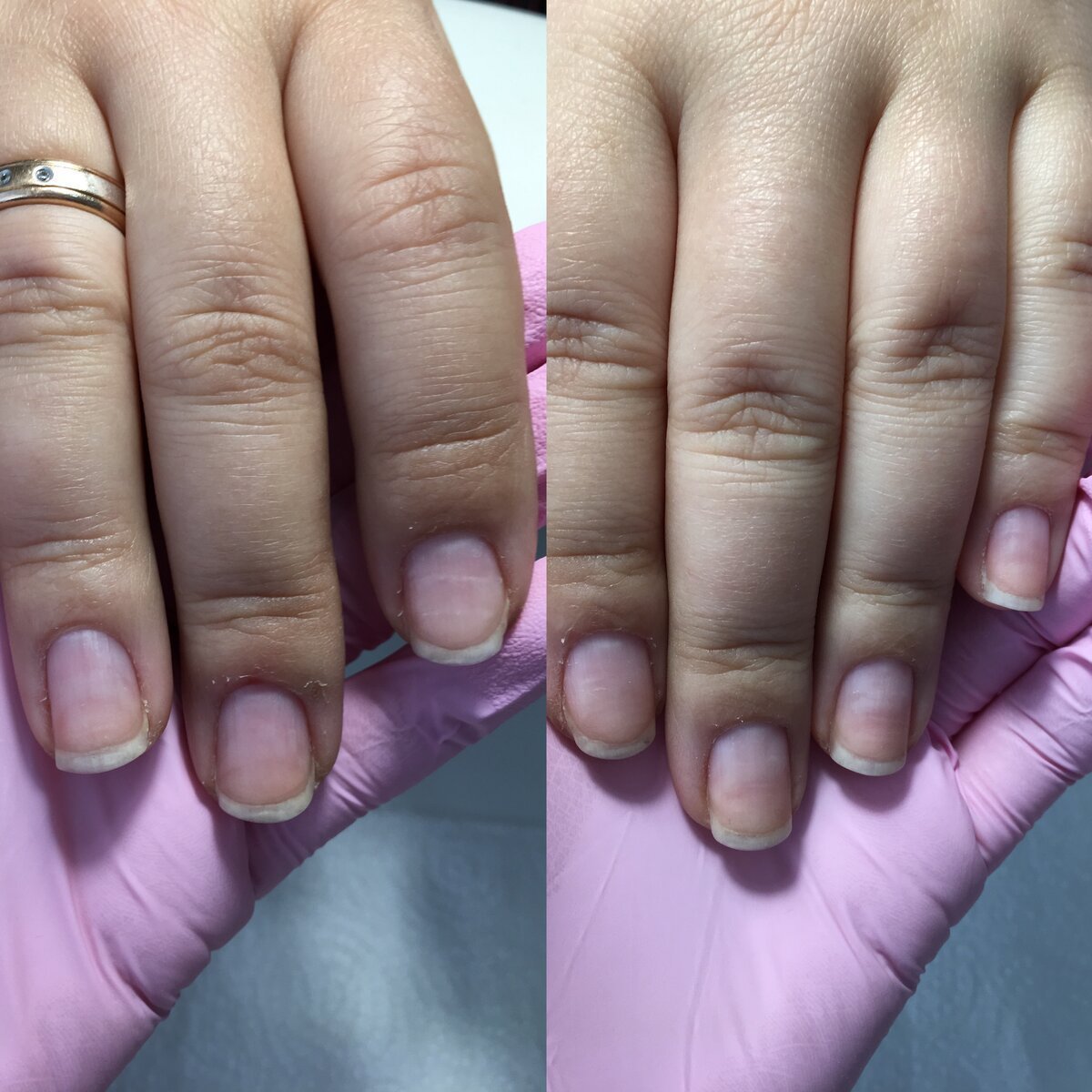 Ногтевая пластика. Мужской маникюр до и после. Широкие ногти. Маникюр на короткие широкие ногти. Маникюр до и после фото.